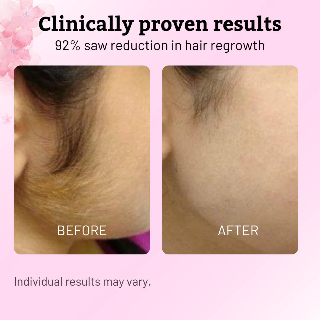 Lurava Cyperus Hair Regrowth Reducer™