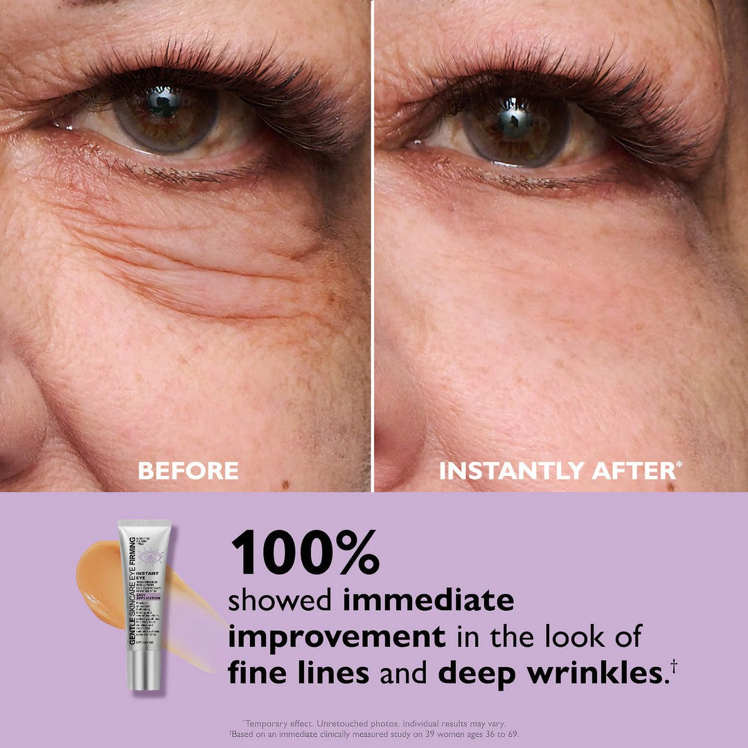 Lurava™ Instant Eye Tightener