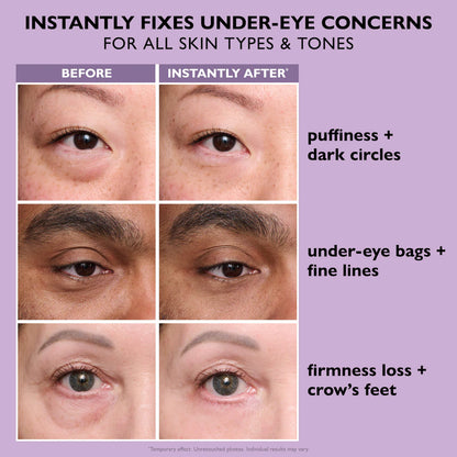Lurava™ Instant Eye Tightener